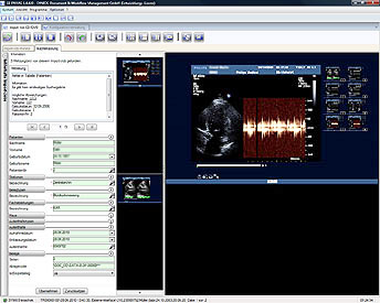 Zoom: Screenshot der SE Connect Bedienoberfläche mit einem Sonogramm als Beispiel